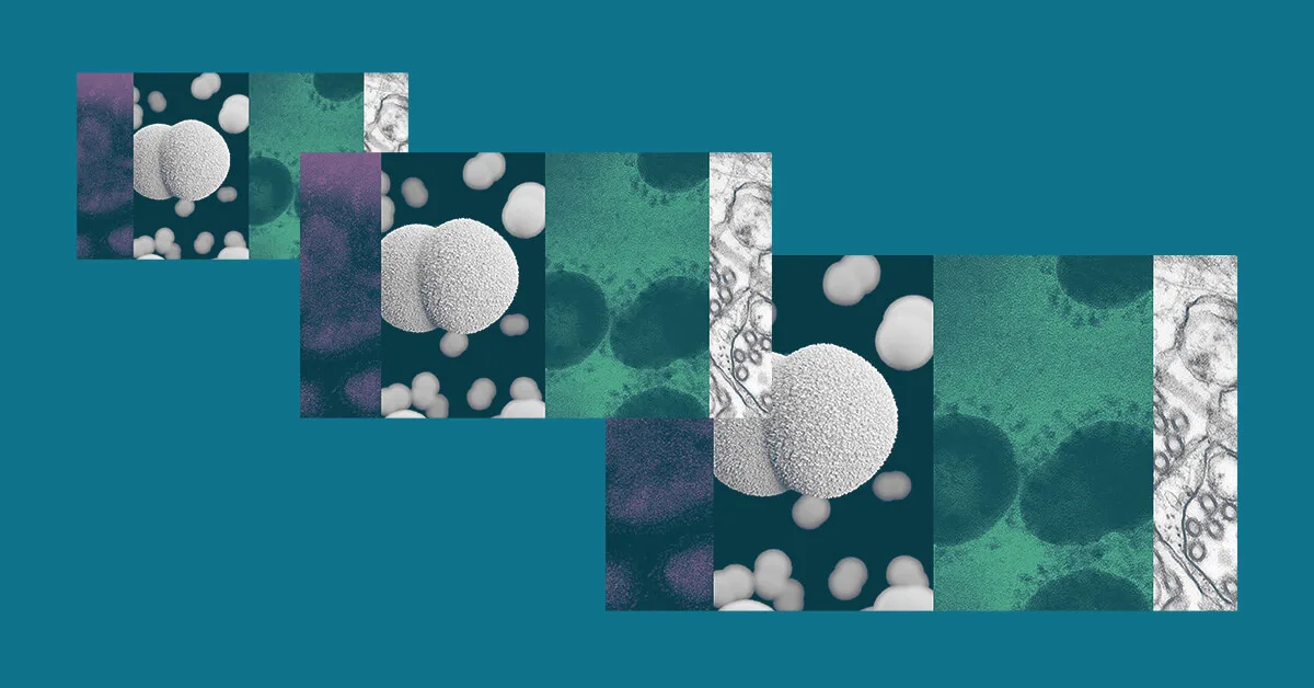 Biggest Single Day Coronavirus Count Biggest Single Day Coronavirus Count